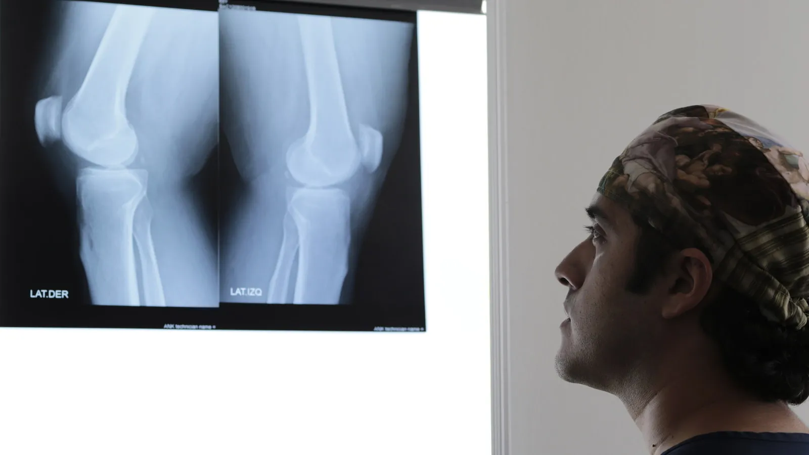 Médico ortopedista revisando radiografías de rodilla en el negatoscopio