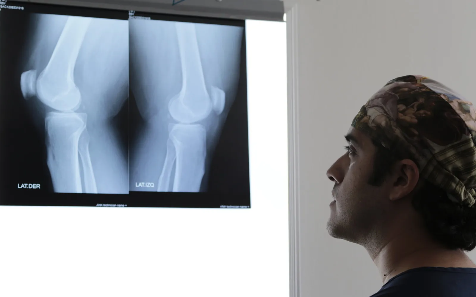 El Dr. Mauricio Céspedes analizando dos radiografías de rodilla en el negatoscopio
